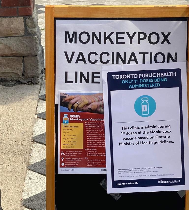 What does monkeypox look like? What to know as Toronto finds new cases